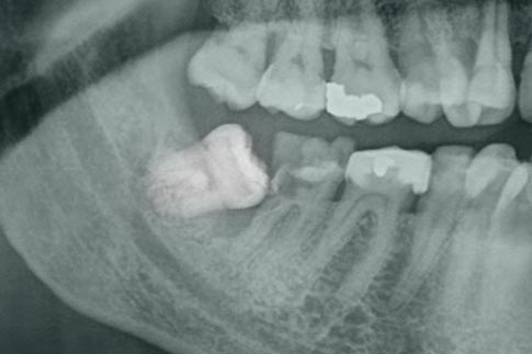 Χειρουργική οδοντιατρική